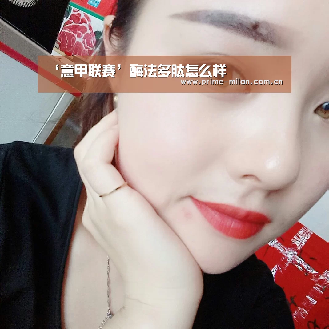 ‘意甲联赛’酶法多肽怎么样(图1) 意大利足球